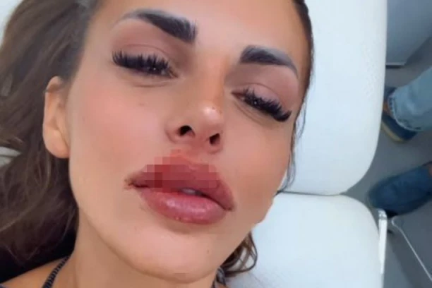 KRVAVA ENA ČOLIĆ! Učesnica "Elite 8" OBELODANILA SVE, evo šta se zapravo dogodilo! (VIDEO)