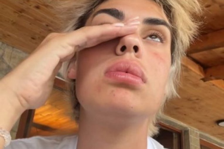 Minina objava na Instagramu