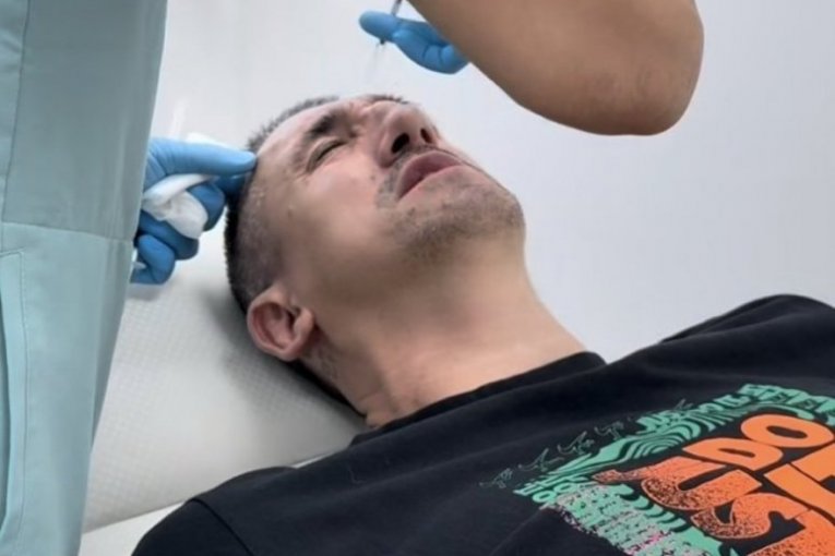 Kristijan Golubović botoks igle žena Kristina Spalević instagram