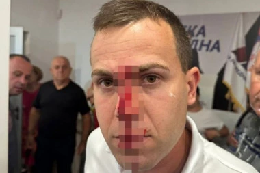 BLOKADERI MLADIĆU RAZBILI GLAVU! Stravična slika stiže iz Lazarevca! (FOTO)