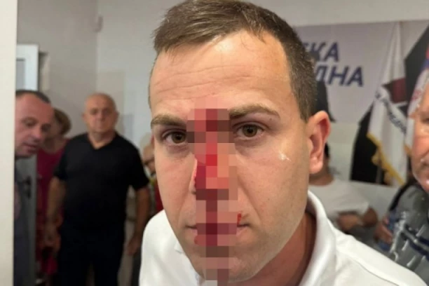 BLOKADERI MLADIĆU RAZBILI GLAVU! Stravična slika stiže iz Lazarevca! (FOTO)