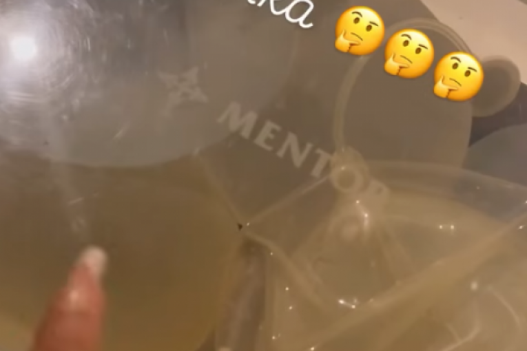 Slađini budući silikoni