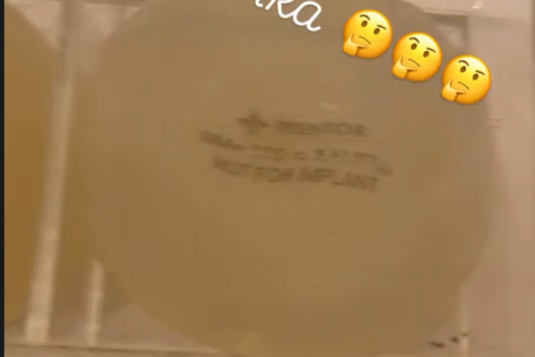 Slađini budući silikoni