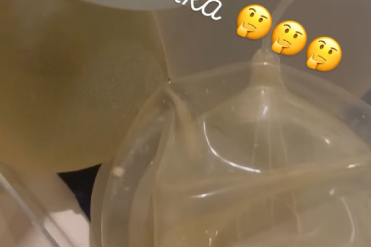 Slađini budući silikoni