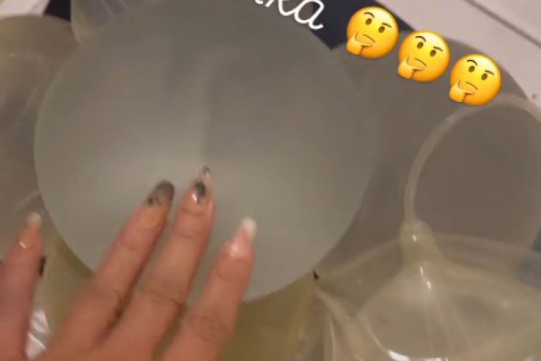 Slađini budući silikoni