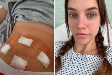 KRVARENJA SU BILA PREOBILNA, VALJALA SE PO PODU OD BOLA! Barbara Pavlin HITNO OPERISANA!