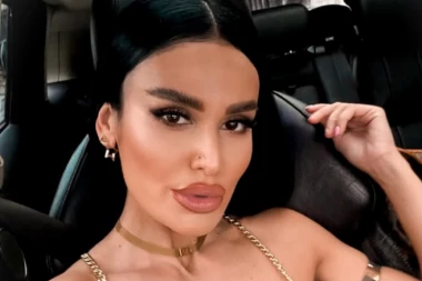 "LEKARI SU MI SE BORILI ZA ŽIVOT": Indi prošla kroz PAKLENU OPERACIJU zbog mršavljenja - sad pokazala zanosnu liniju! (FOTO)