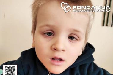 ON NE SEDI, NE HODA I NE GOVORI: Dominiku je potrebna naša pomoć kako bi se izborio sa genetskom mutacijom