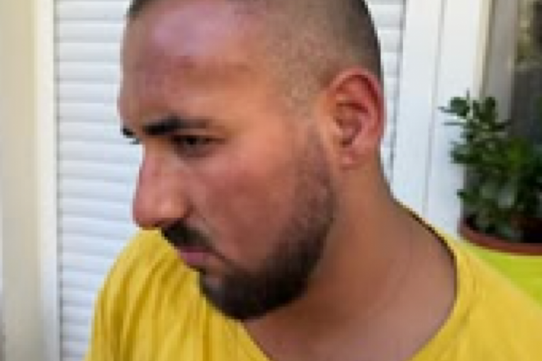 Peca Lazić pretučen