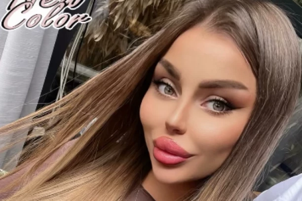 DA LI BISTE JE PREPOZNALI? Sofija Janićijević se nakon niza operacija ODLUČILA I ZA OVAJ POTEZ - ŠOK! (GALERIJA)