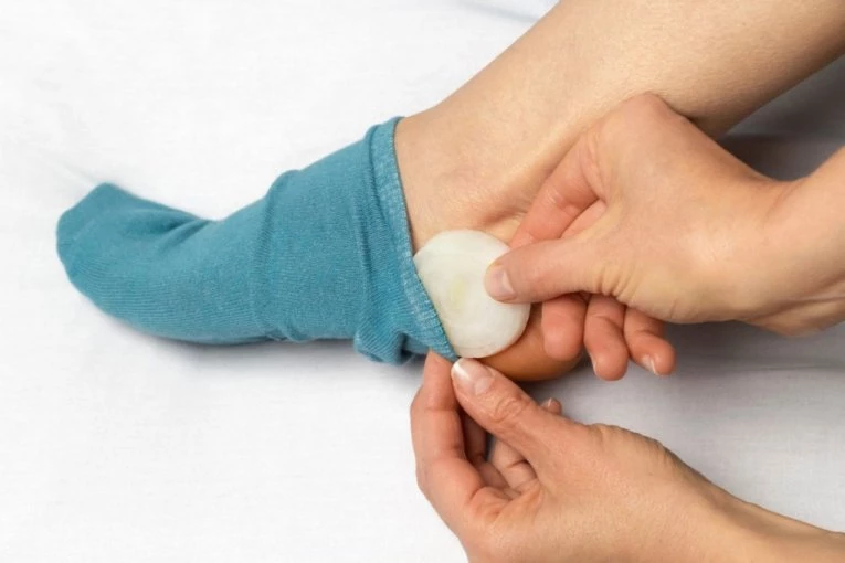 Prespavala je sa CRNIM LUKOM u čarapama: Ujutru nije mogla da veruje očima, ovaj TRIK Kinezi koriste 1.000 godina