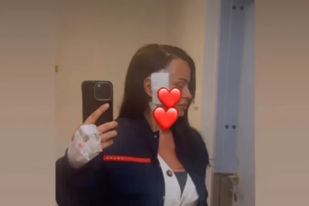 BIVŠOJ ZADRUGARKI OPERISAN TUMOR NA MOZGU: Saopštenje lekara je RAZOČARALO! (FOTO)