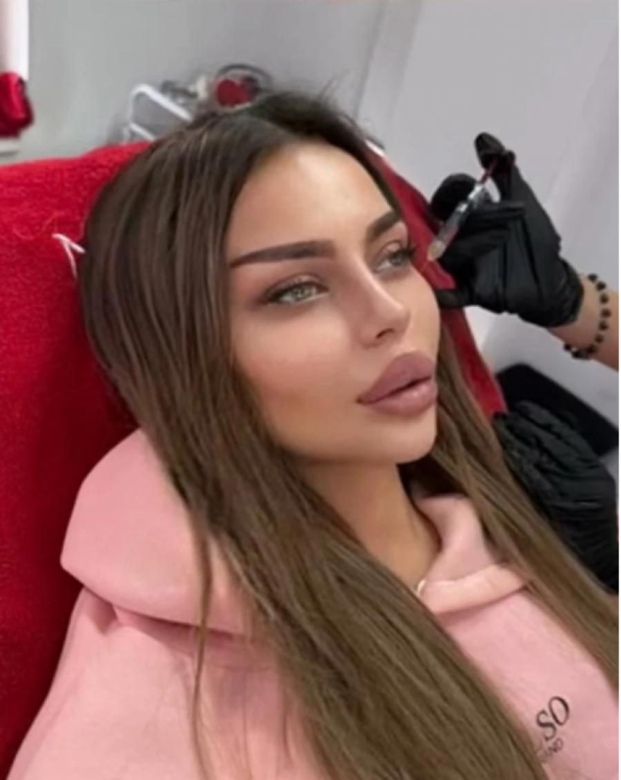 SOFIJA ISTA SITA AHMIĆ?! Potrošila pravo BOGATSTVO na plastične OPERACIJE, vše ne liči na sebe - fanovi FRAPIRANI! (FOTO)