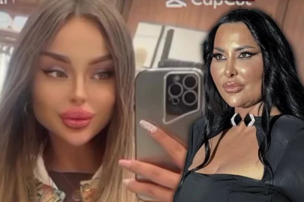 SOFIJA ISTA SITA AHMIĆ?! Potrošila pravo BOGATSTVO na plastične OPERACIJE, vše ne liči na sebe - fanovi FRAPIRANI! (FOTO)