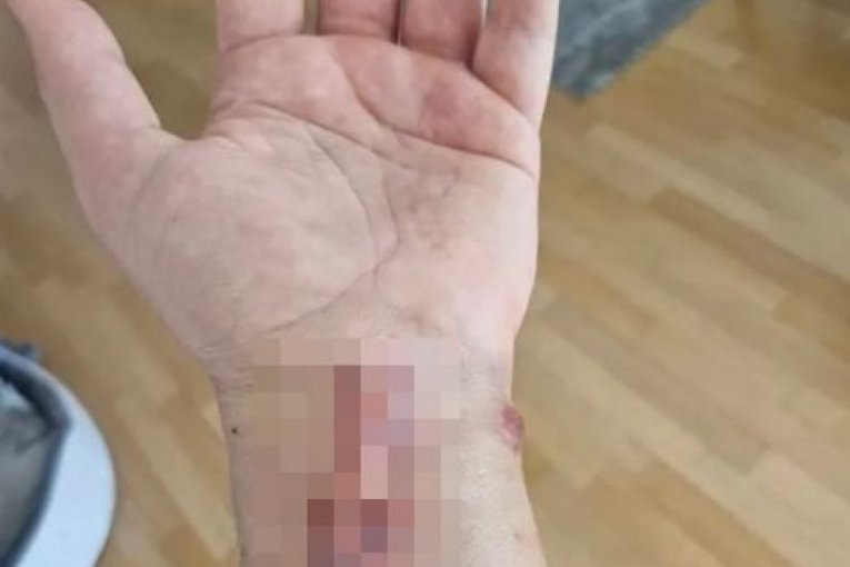 Operisan Aleksandar Stanković