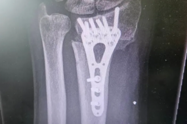 Operisan Aleksandar Stanković