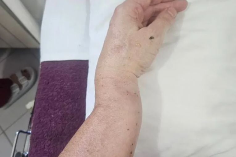 Operisan Aleksandar Stanković