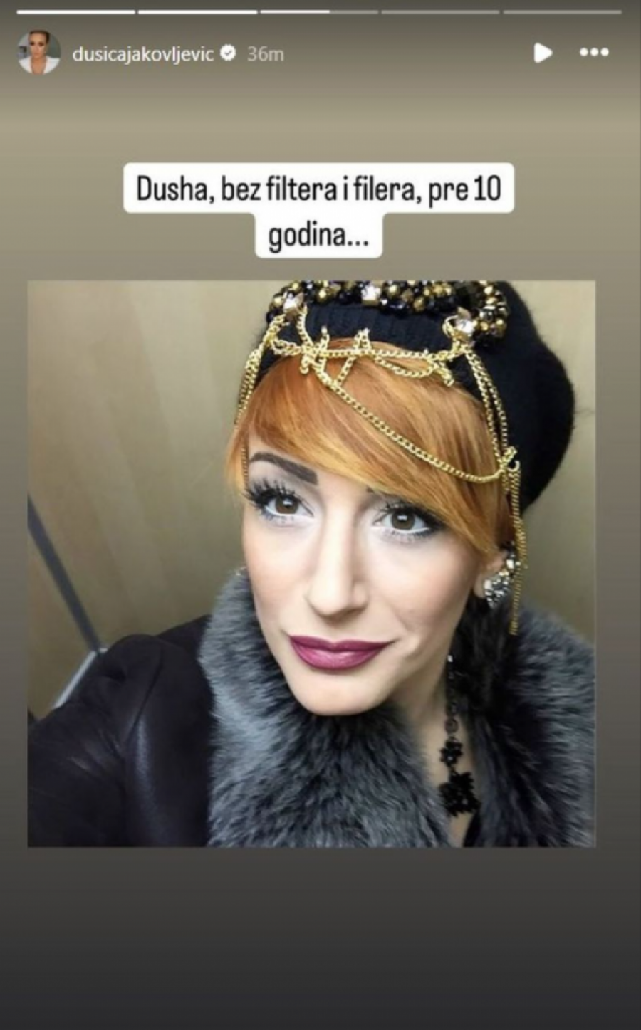 BEZ FILTERA I FILERA: Dušica Jakovljević danas važi za bombu, a ovako je izgledala pre svih ESTETSKIH OPERACIJA! (GALERIJA)