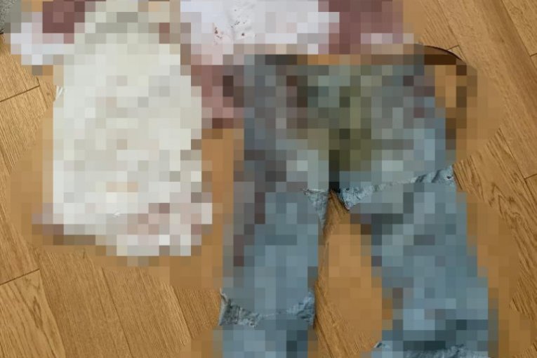 Zoranova krvava odeća