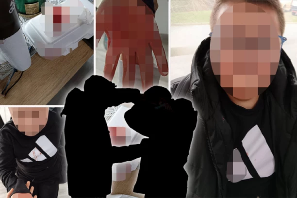 "JEDAN GA JE UDARAO U GLAVU, DETE JE U ŠOKU!" Oglasila se majka pretučenog dečaka u Vlasotincu za Republiku: UPUTILA HITAN APEL! (UZNEMIRUJUĆE FOTOGRAFIJE)