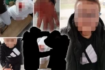 "JEDAN GA JE UDARAO U GLAVU, DETE JE U ŠOKU!" Oglasila se majka pretučenog dečaka u Vlasotincu za Republiku: UPUTILA HITAN APEL! (UZNEMIRUJUĆE FOTOGRAFIJE)
