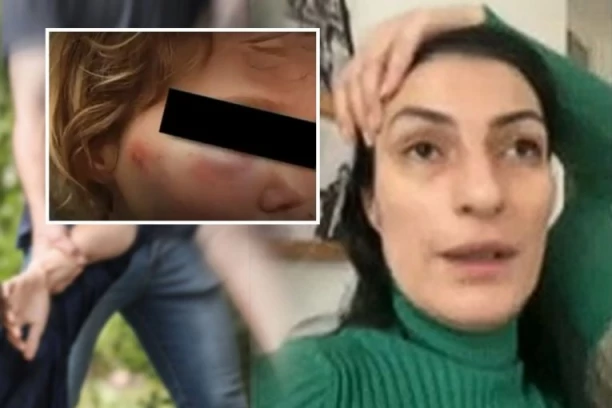 MAJKA MALTRETIRANOG DEČAKA OGOLILA DUŠU! Dve generacije žrtava! "Stariji sin je trpeo nasilje, a malom Vuku sada ponovo viču Ćaci“