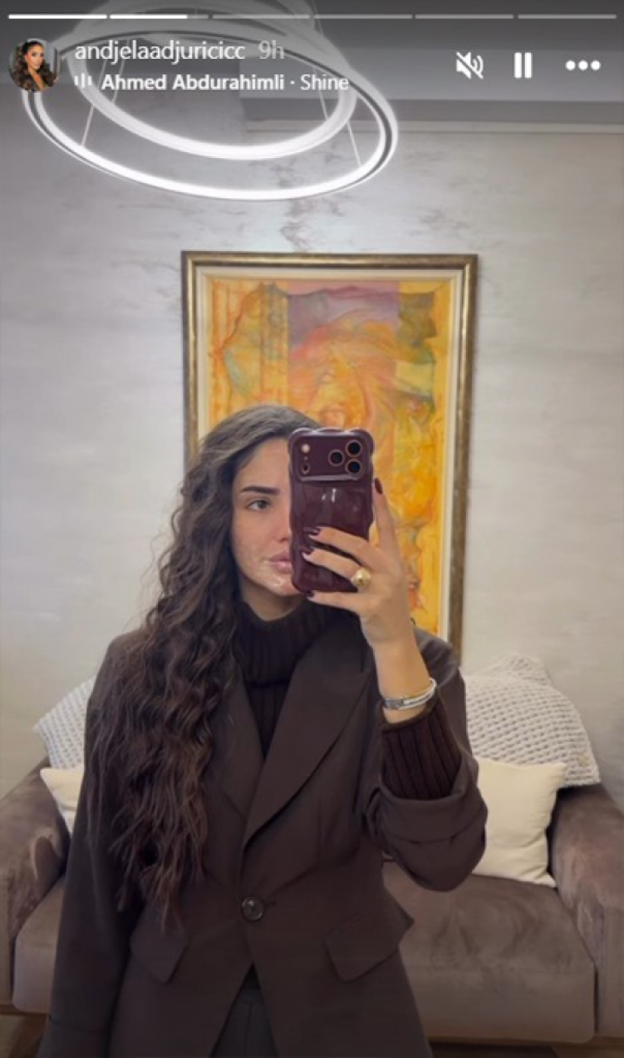 ŠOK! ANĐELA ĐURIČIĆ POTPUNO PROMENILA LIČNI OPIS! Nakon operacije nosa UKLONILA I SVOJ ZAŠTITNI ZNAK - evo kako sada izgleda! (FOTO)