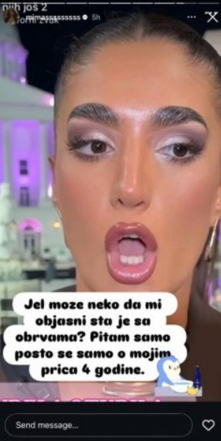 ŠOK! ANĐELA ĐURIČIĆ POTPUNO PROMENILA LIČNI OPIS! Nakon operacije nosa UKLONILA I SVOJ ZAŠTITNI ZNAK - evo kako sada izgleda! (FOTO)