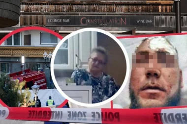 LICE MU SPALJENO! Potresne slike Srbina koji je bio u baru smrti u Švajcarskoj, baka Dobrila u suzama: Bolje da crknem, nego...