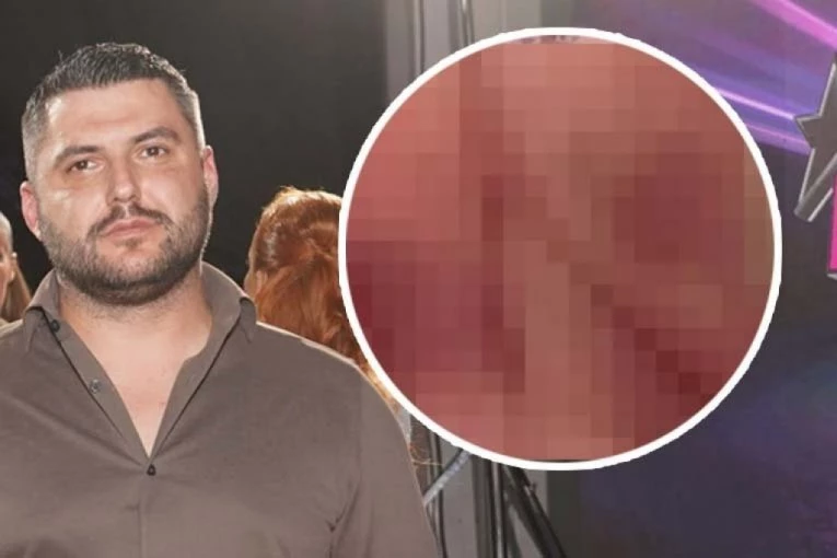 GROZNO! POJAVILI MU SE MODRI PEČATI PO TELU! Uznemirujuć snimak Asmina Durdžića! (FOTO)