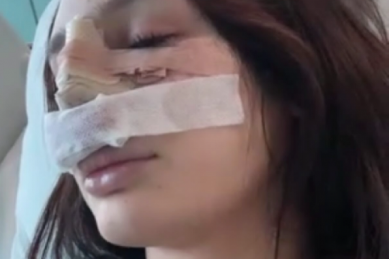 Nina Đogani operisala nos