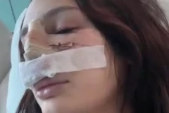PRVA SLIKA NOVOG NOSA NINE ĐOGANI! Isplivao snimak Lunine sestre posle operacije!