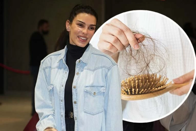 BIVŠOJ MANEKENKI OPADA KOSA! Ovim pitanjem zabrinula sve pratioce!
