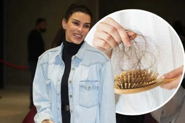BIVŠOJ MANEKENKI OPADA KOSA! Ovim pitanjem zabrinula sve pratioce!