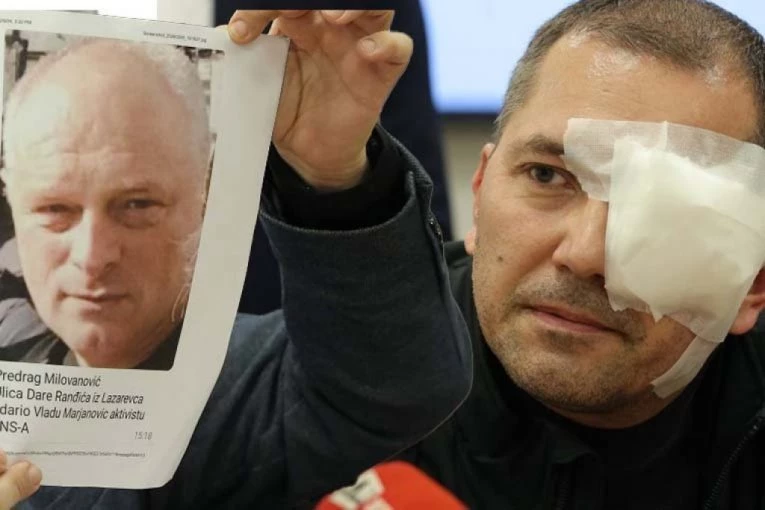 UŽAS U ARANĐELOVCU! Blokaderi urnisali čoveka - ZADOBIO TEŠKU POVREDU OKA, LEKARI SE BORE DA MU SPASU VID! (FOTO, VIDEO)