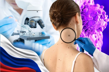 BORBA PROTIV RAKA DOBIJA NOVO ORUŽJE! Ruski naučnici razvijaju REVOLUCIONARNU terapiju!