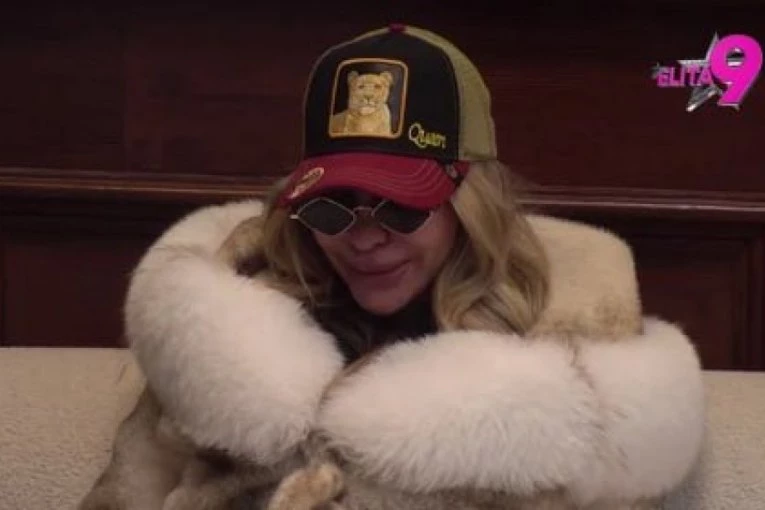 NAJNOVIJE VESTI O STANJU ANELI AHMIĆ: Lice u STRAVIČNOM stanju, rane mogu da se INFICIRAJU! (FOTO)