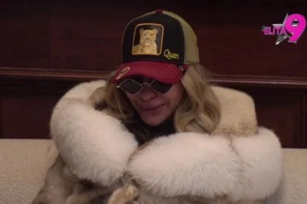 NAJNOVIJE VESTI O STANJU ANELI AHMIĆ: Lice u STRAVIČNOM stanju, rane mogu da se INFICIRAJU! (FOTO)