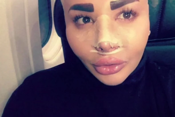 JEZIVO! RIJALITI-ZVEZDA UMRLA ZBOG SILIKONA!? Dve osobe uhapšene! (FOTO)