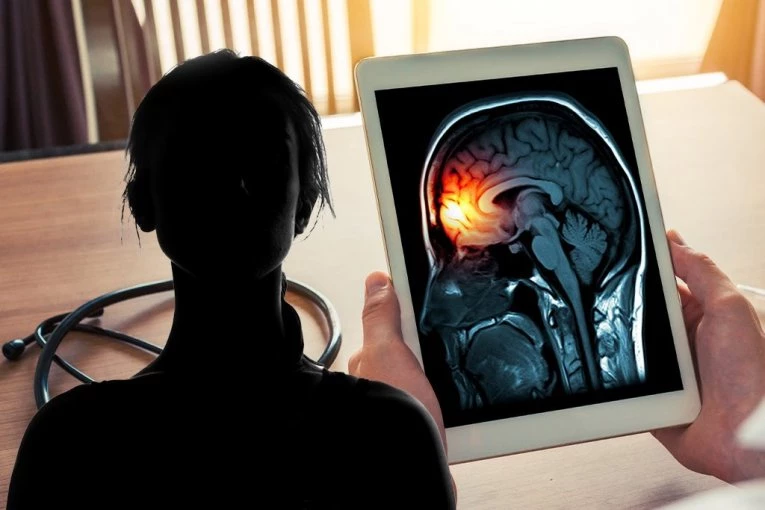 ZARAZILA SE VEJPOM? Studentkinja preminula od meningitisa, a sada se EPIDEMIJA ŠIRI ZEMLJOM brzinom svetlosti!