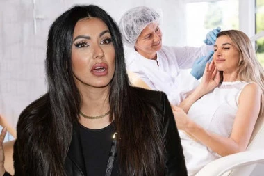 UNAKAŽENO LICE TANJE SAVIĆ! Pevačicino telo se borilo protiv filera! (VIDEO)