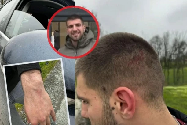 KRVNIČKI PRETUČEN VUKAŠIN ĐOKOVIĆ! Divljaci razbili auto aktivisti SNS u Smederevskoj Palanci, pa ga brutalno prebili! (FOTO, VIDEO)