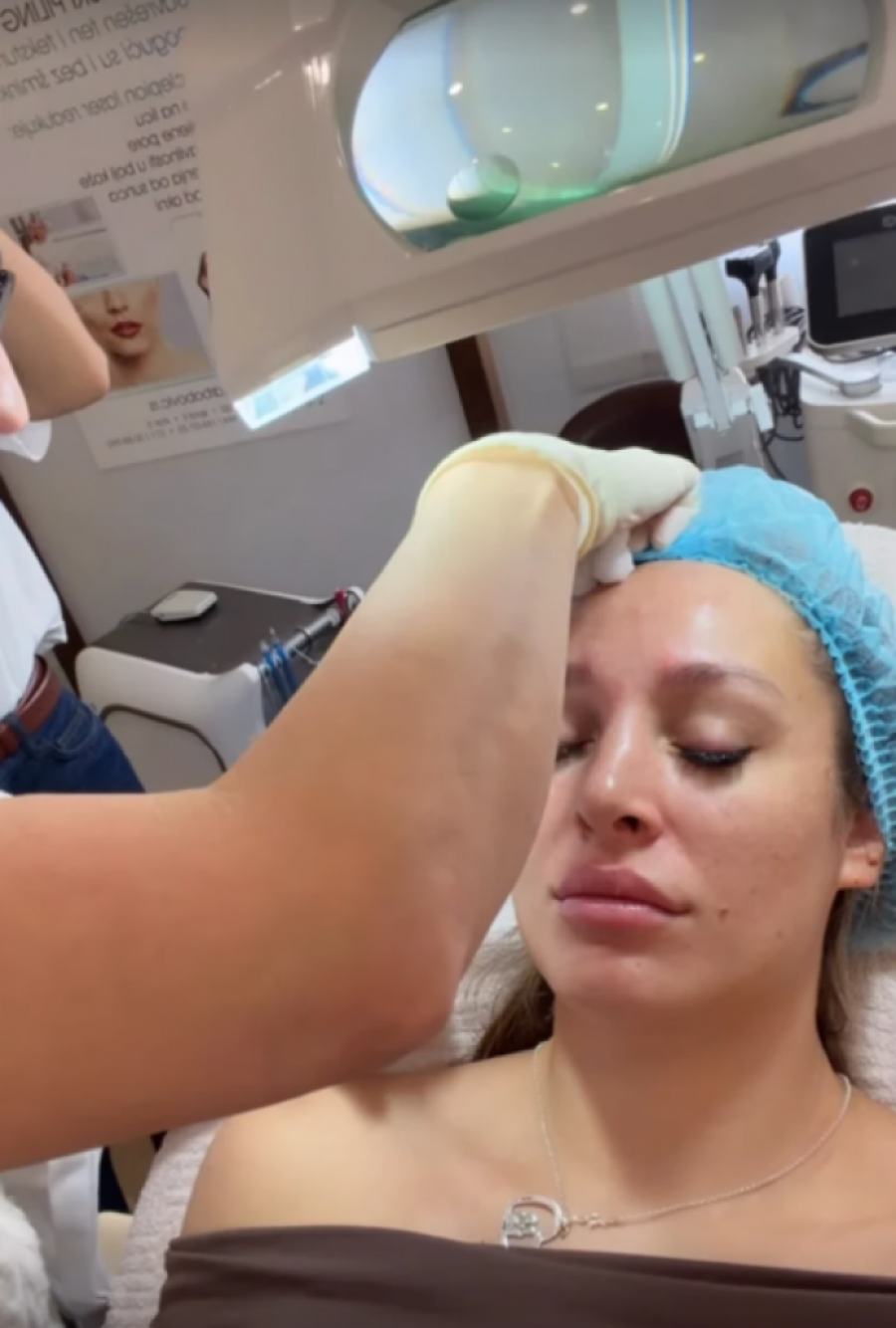 LUNA ĐOGANI UBRIZGALA BOTOKS U LICE: Evo kako sada izgleda nakon INTERVENCIJE!