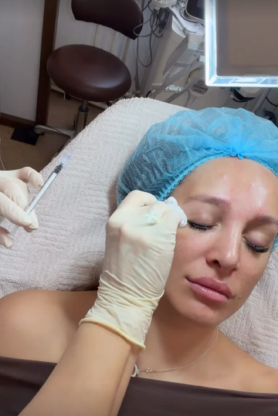 LUNA ĐOGANI UBRIZGALA BOTOKS U LICE: Evo kako sada izgleda nakon INTERVENCIJE!