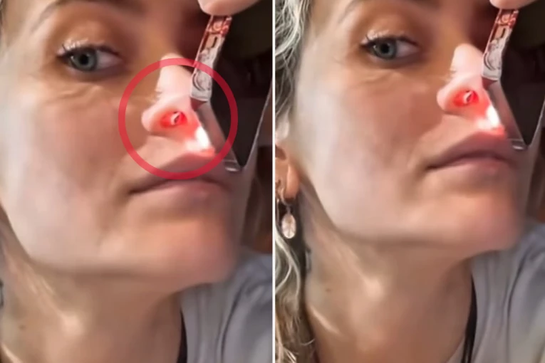 DROGA JOJ UNAKAZILA NOS! Ćerka pokojnog pevača otkrila KAKO DIŠE sa IZBUŠENIM NOZDRVAMA! Snimak POTRESAO sve! (UZNEMIRUJUĆE)