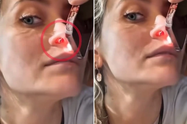 DROGA JOJ UNAKAZILA NOS! Ćerka pokojnog pevača otkrila KAKO DIŠE sa IZBUŠENIM NOZDRVAMA! Snimak POTRESAO sve! (UZNEMIRUJUĆE)