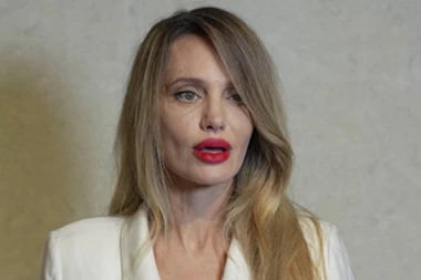 LJUDI, ŠTA JE S GLUMICOM? Pojavila se JEZIVA TEORIJA nakon slika OSUŠENOG TELA i DEFORMISANE GLAVE! (FOTO)