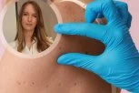 Dr Bojana Novović, dermatovenerolog: Jedna promena na MLADEŽU može biti opasna – proverite da li ste u riziku!