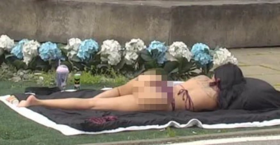 MAJINA SILIKONSKA ZADNJICA TOTALNO IZOBLIČENA NAKON POSLEDNJEG INCIDENTA! Starleta hitno mora kod doktora, kako se OVO desilo?!