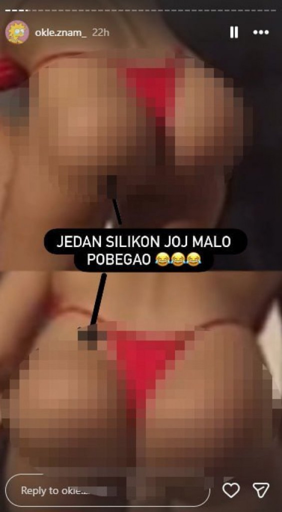 LJUDI, ŠTA SE DEŠAVA SA ZADNJICOM MAJE MARINKOVIĆ? Taki zabrinut zbog DEFORMISANIH silikona mezimice! (FOTO)